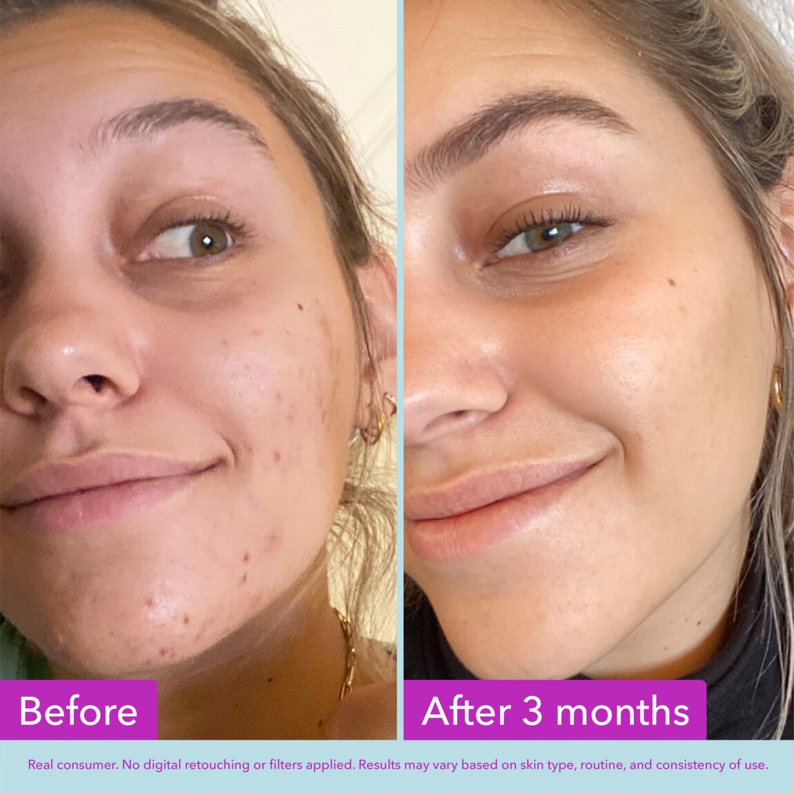 niacinamide-brightening-toner-k1 zb_p.jpg
