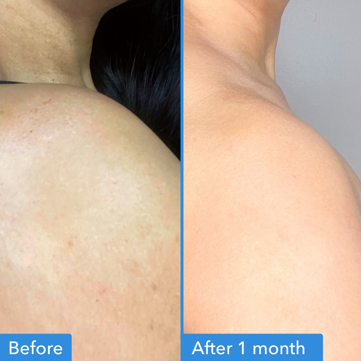 discoloration-correcting-body-treatment-s5 zb_p.jpg