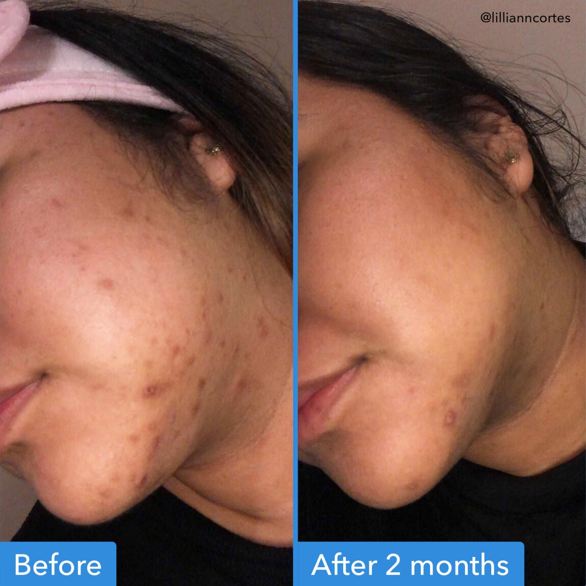 discoloration-correcting-serum-l1 zb_p.jpg